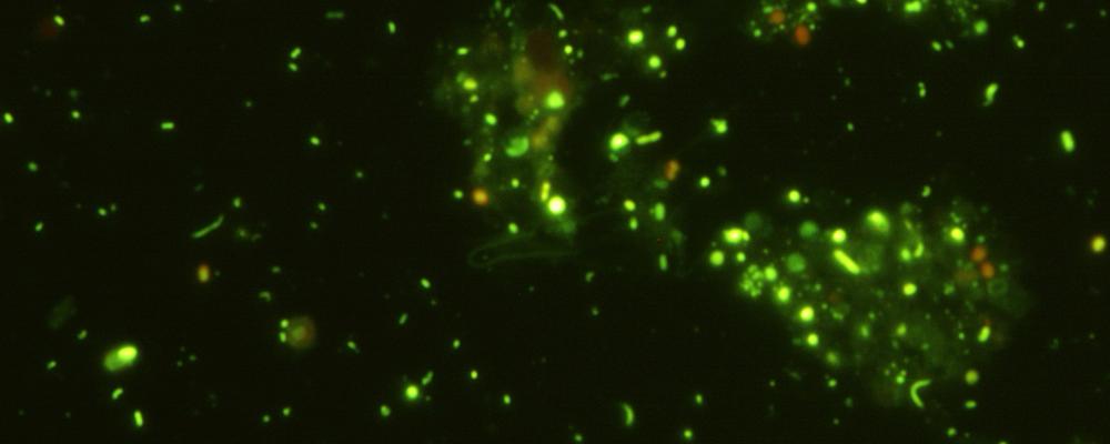 green glowing microbes under the microscope